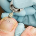 leistungen podologische fusspflege 150x150